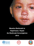 Measles Outbreak Investigation.pdf.jpg